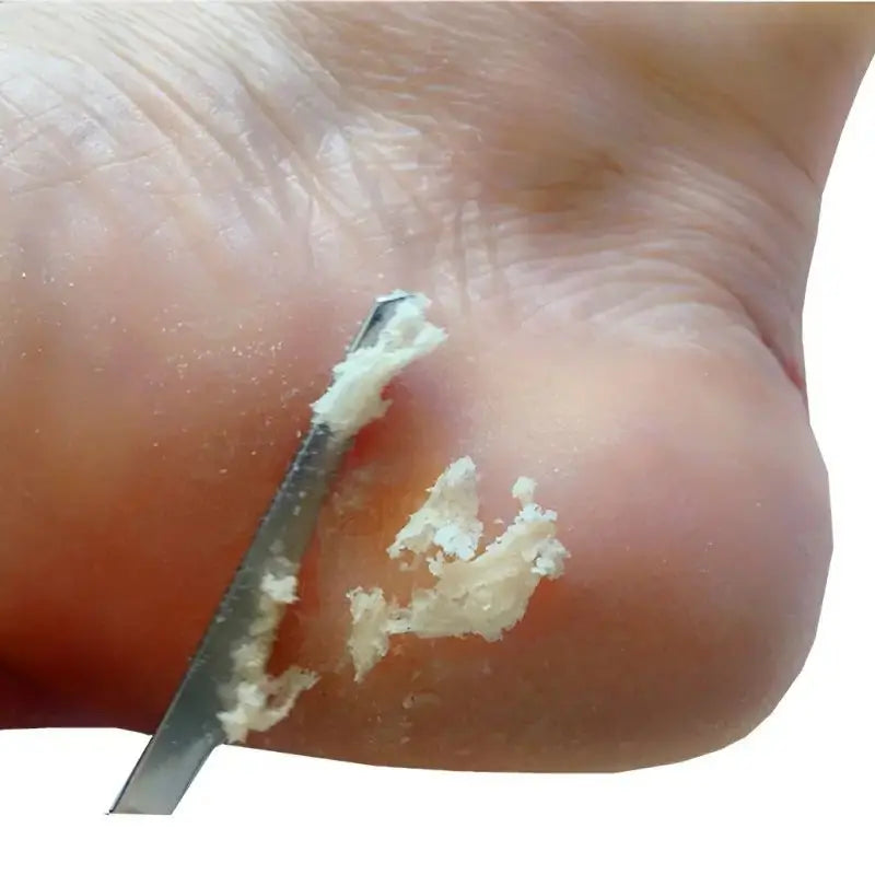 Hemasa Stainless Steel Foot Knife - Dead Skin Remover, Toe Nail Shaver, And Callus Rasp For Pedicure And Foot Care for Shops
