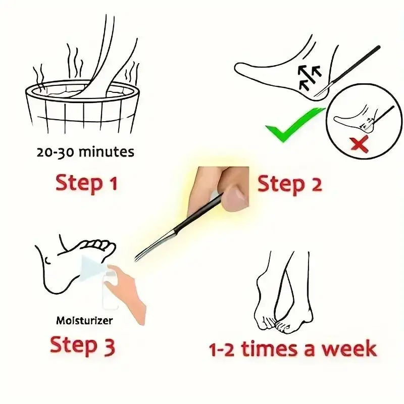 Hemasa Stainless Steel Foot Knife - Dead Skin Remover, Toe Nail Shaver, And Callus Rasp For Pedicure And Foot Care for Shops